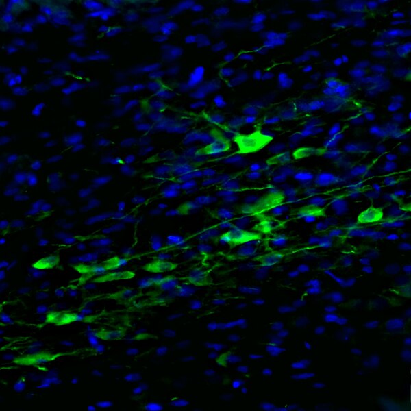 Immunofluorescent image of a rat brain labeled with DSHB antibody Anti-TH [BCN33.1.1F12] against tyrosine hydroxylase (green). Image credit: C. Ritchey, D. Rossi and J. Peters, Washington State U.